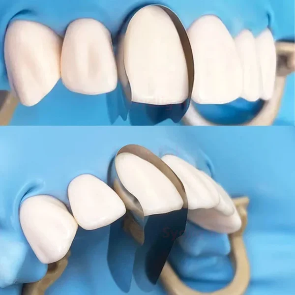 Dental Matrix Contoured Anterior Metal - Image 5