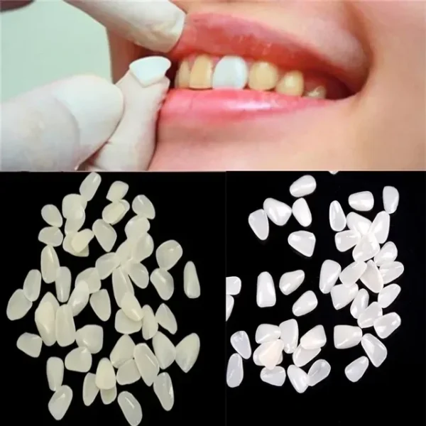 Dental Temporary Veneers Resin Ultra Thin