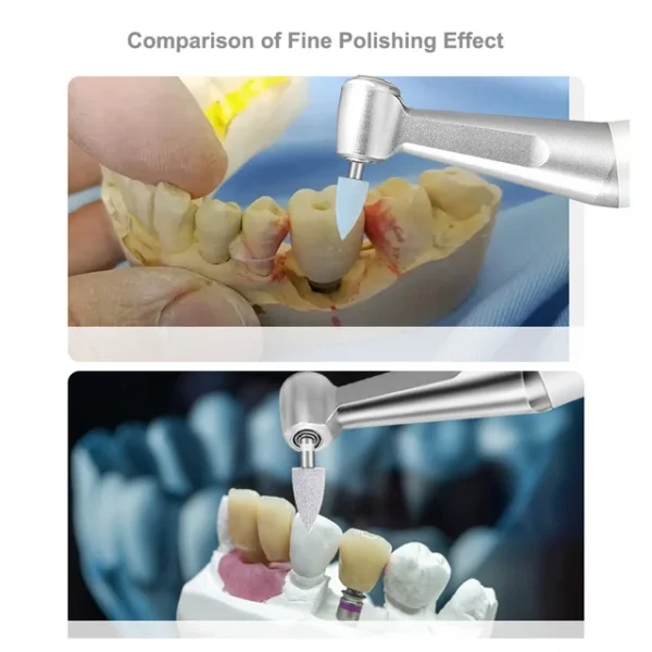 Dental Composite Resin Polishing Kit 4pcs - Image 4