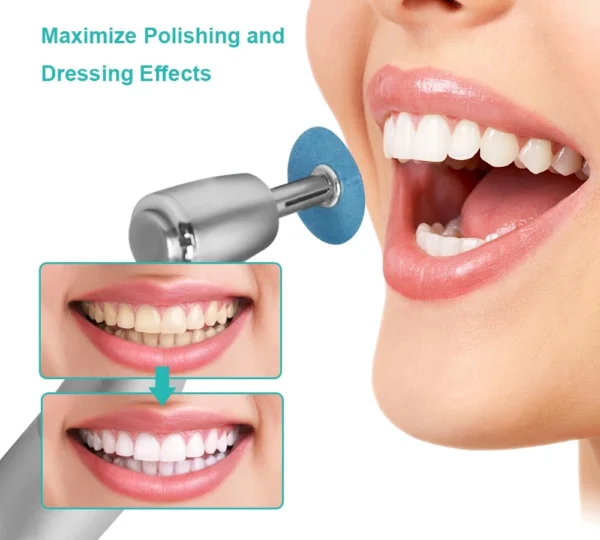 Dental Polishing Discs