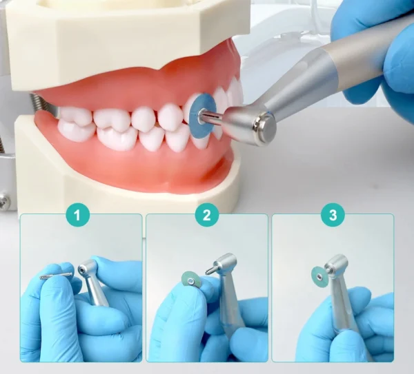 Dental Polishing Discs - Image 2