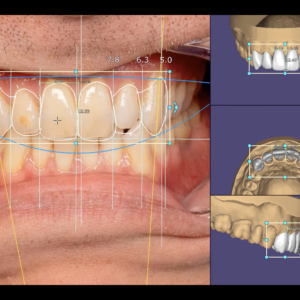 Smile Design Plan